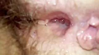 Fucks сувилагч нь том олз.